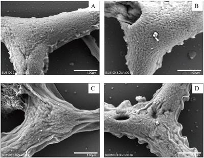 Mechanisms of ROS-induced mitochondria-dependent apoptosis in Phaeodactylum tricornutum under AgNPs exposure